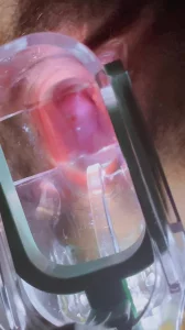 扩阴器 优质原创视频在线直达